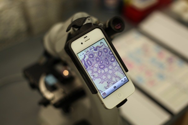 Переходник Magnifi позволяет делать на iPhone снимки телескопом и микроскопом