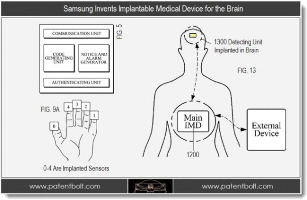 В Samsung придумали имплант для мозга, который будет мониторить ваше здоровье