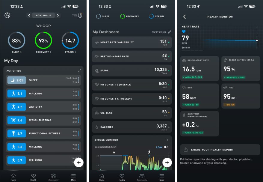 Обзор Whoop MG: лучший фитнес-трекер с одной оговоркой картинка Whoop MG