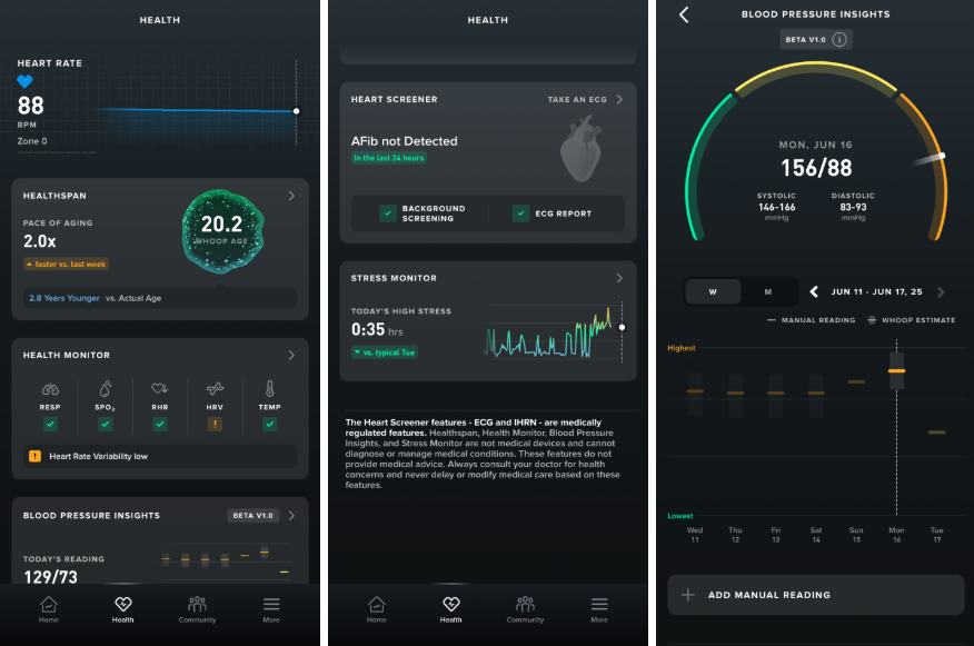 Обзор Whoop MG: лучший фитнес-трекер с одной оговоркой картинка Whoop MG