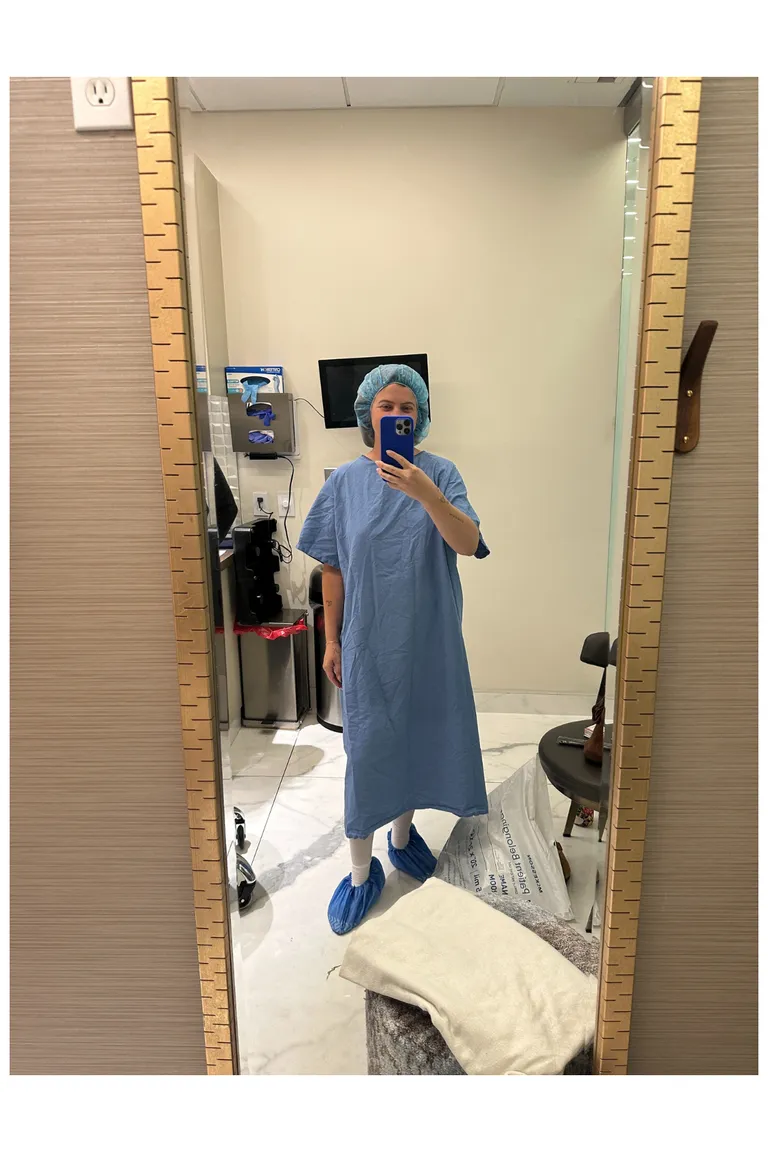 Подтяжка бровей вместо блефаропластики – мой опыт-3