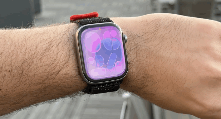 Apple Watch Series 11