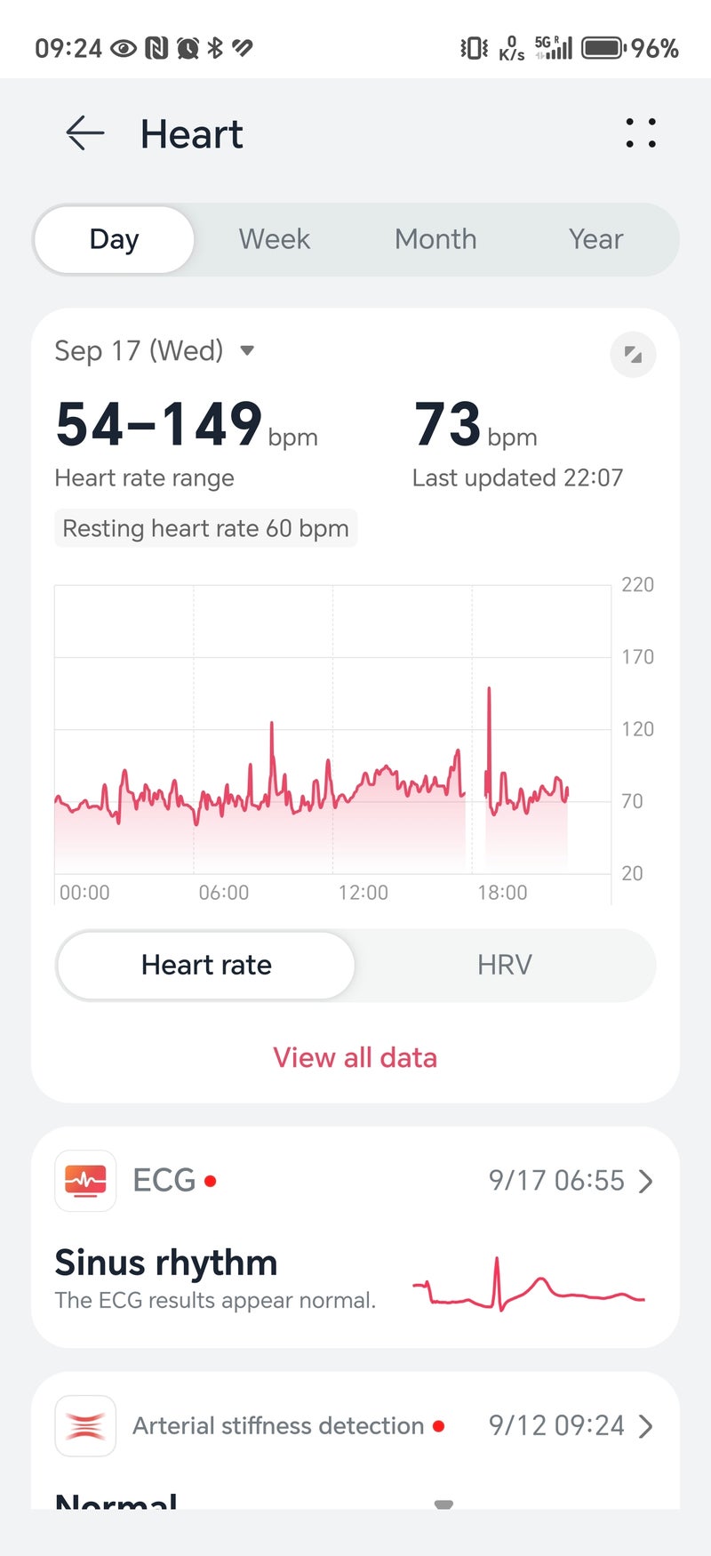 Обзор Huawei Watch GT6 Pro: часы с отличной автономностью картинка Huawei Watch GT6 Pro