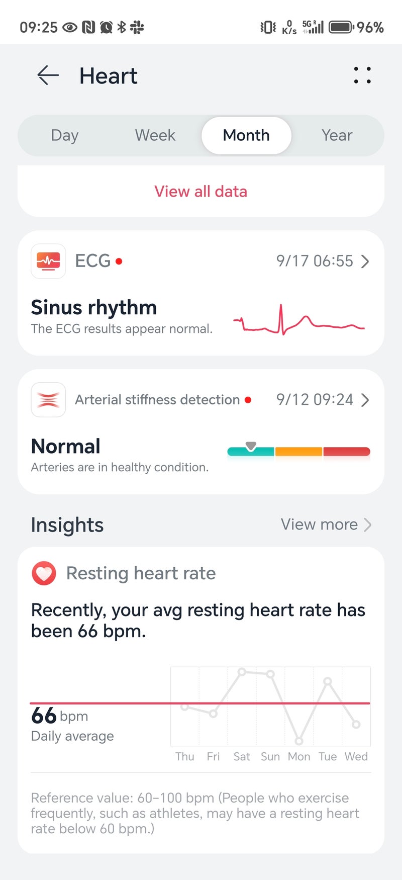 Обзор Huawei Watch GT6 Pro: часы с отличной автономностью картинка Huawei Watch GT6 Pro