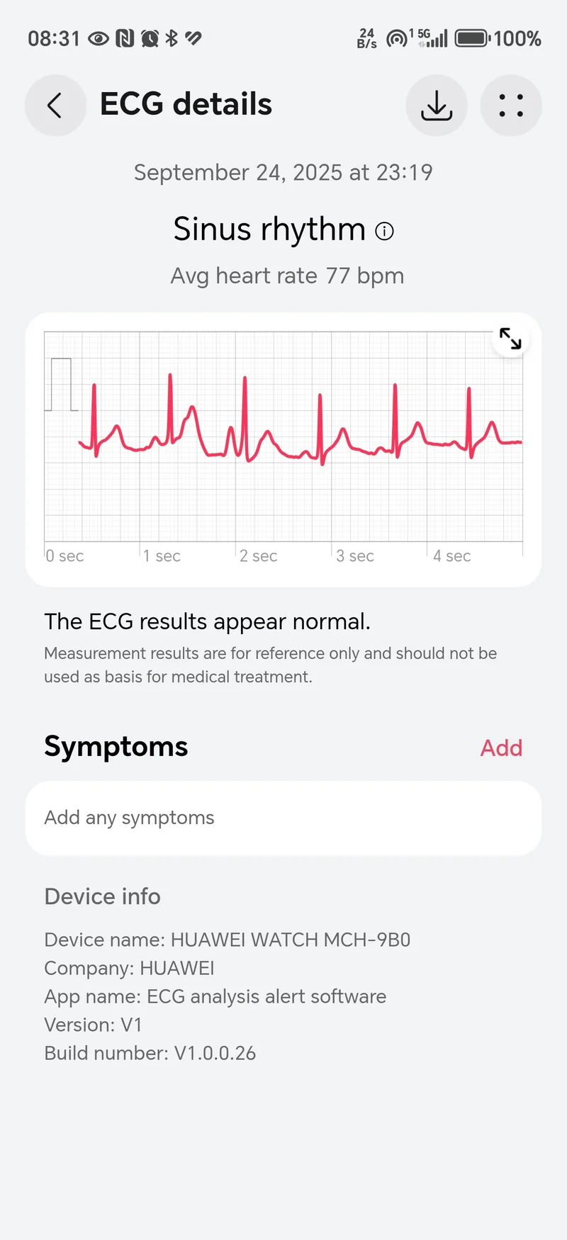 Обзор Huawei Watch Ultimate 2 — отличные часы для дайвинга стали еще лучше картинка Huawei Watch Ultimate 2