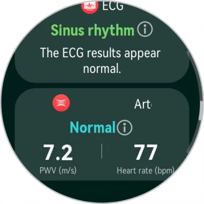 Huawei Watch Ultimate 2