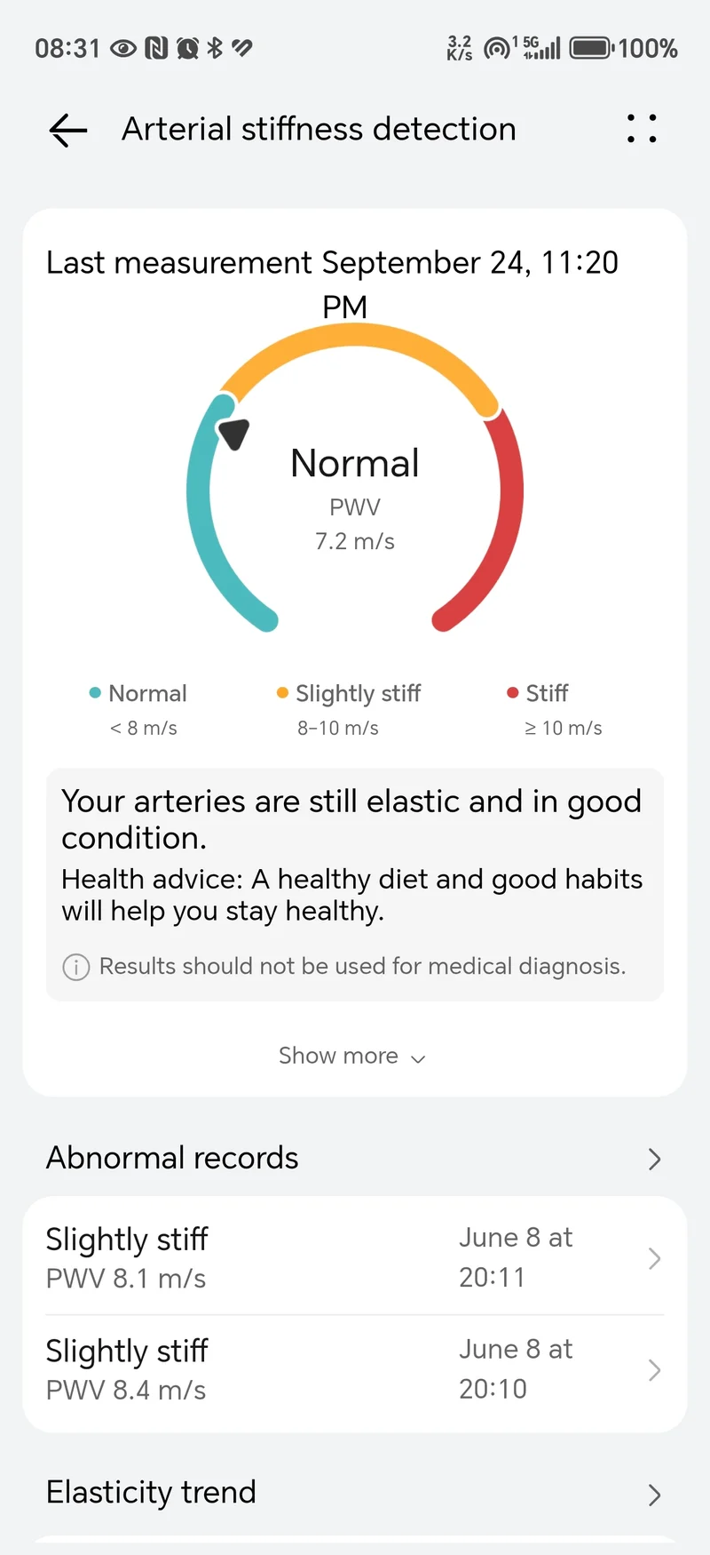 Обзор Huawei Watch Ultimate 2 — отличные часы для дайвинга стали еще лучше картинка Huawei Watch Ultimate 2
