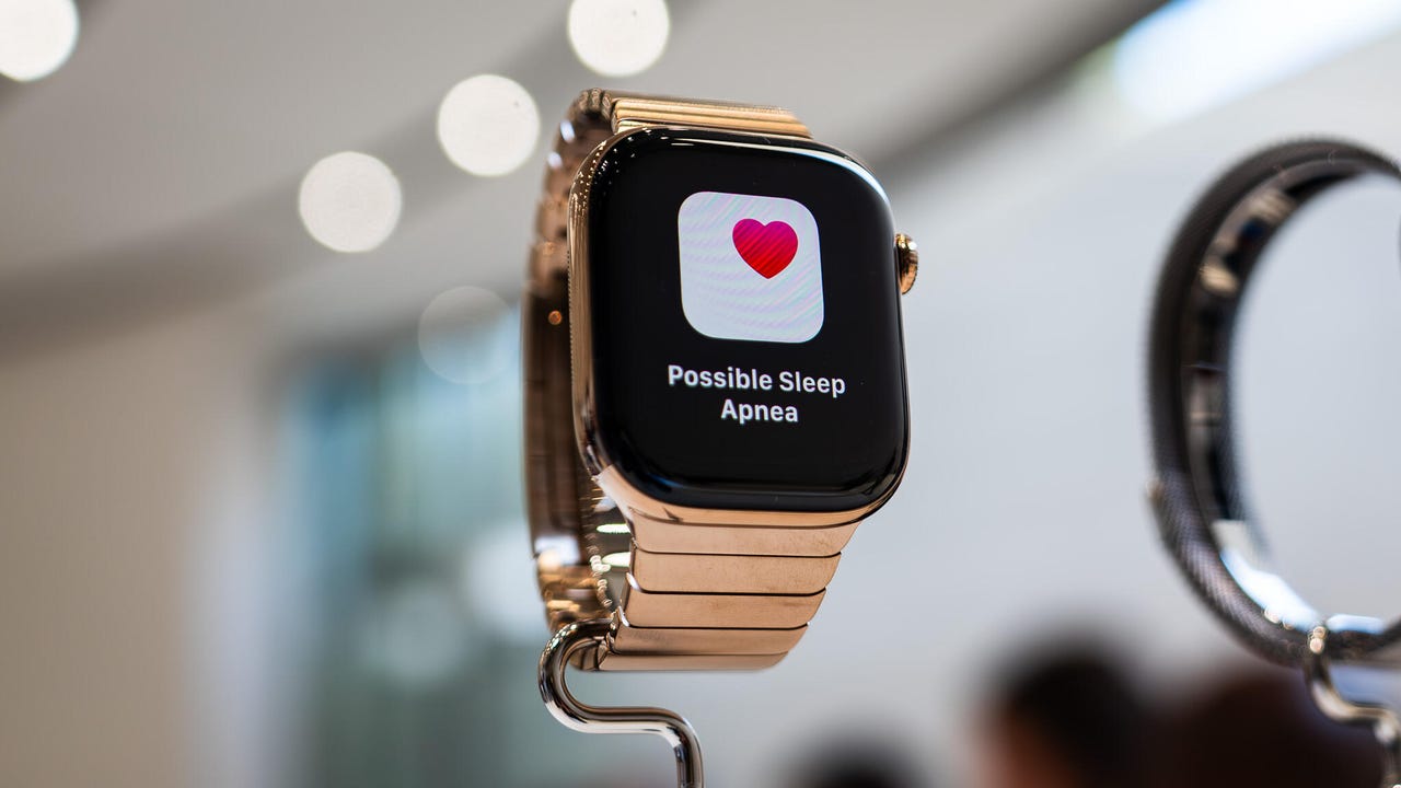 И снова на троне? Почему Apple Watch Series 11 оставят всех позади