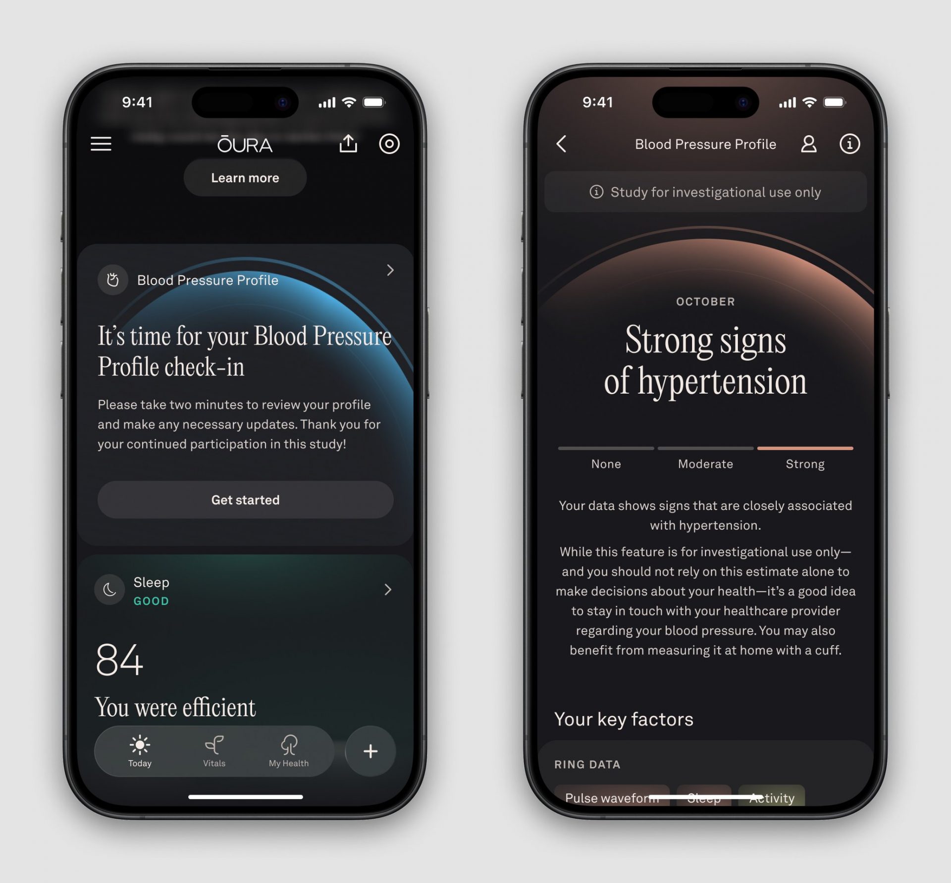 Смарт-кольца Oura: крупное обновление приложения