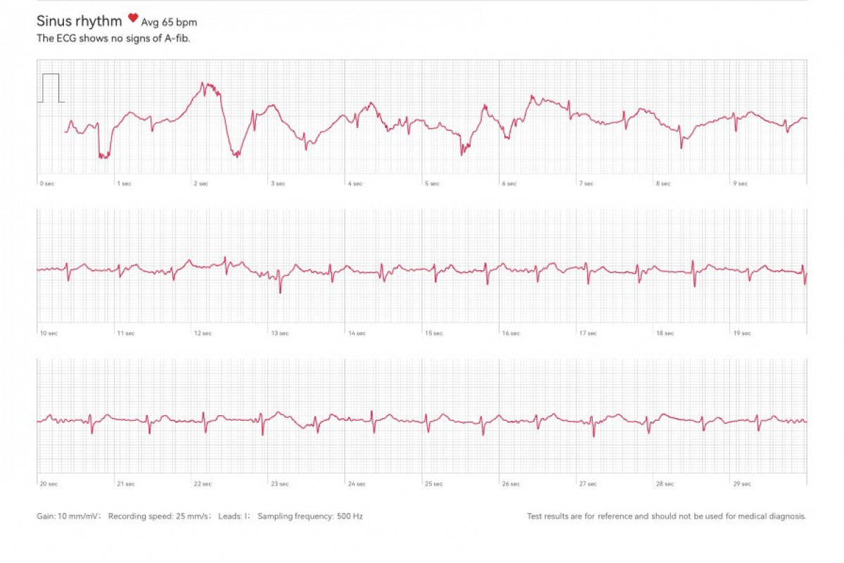 Обзор Huawei Watch GT 6 Pro: надежные умные часы для любителей фитнеса картинка Huawei Watch GT 6 Pro