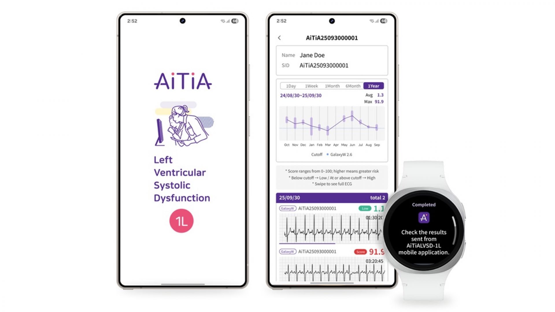 Мыслеуправление: Samsung разрабатывает наушники для чтения мыслей