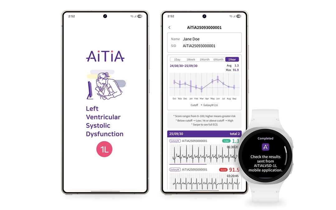 488496Ваши часы Samsung скоро смогут спасти вам жизнь, обнаружив смертельное заболевание сердца