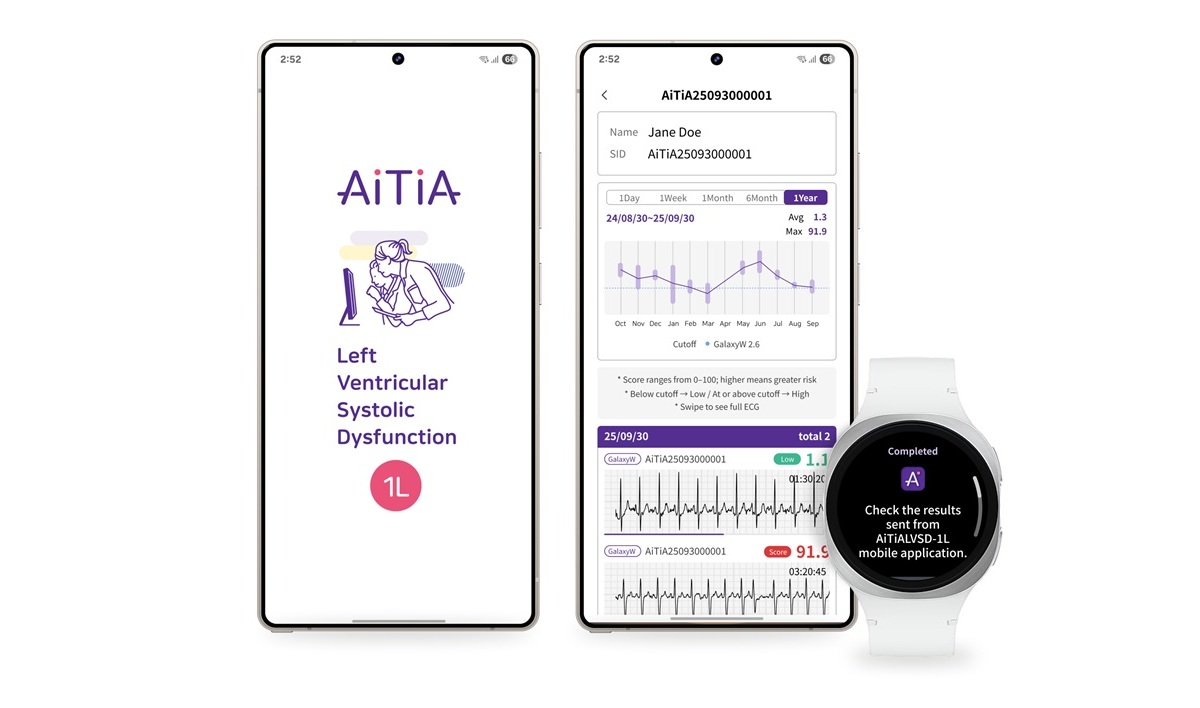Ваши часы Samsung скоро смогут спасти вам жизнь, обнаружив смертельное заболевание сердца фото